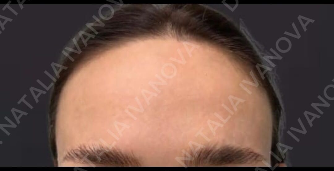 Home 206 botox1