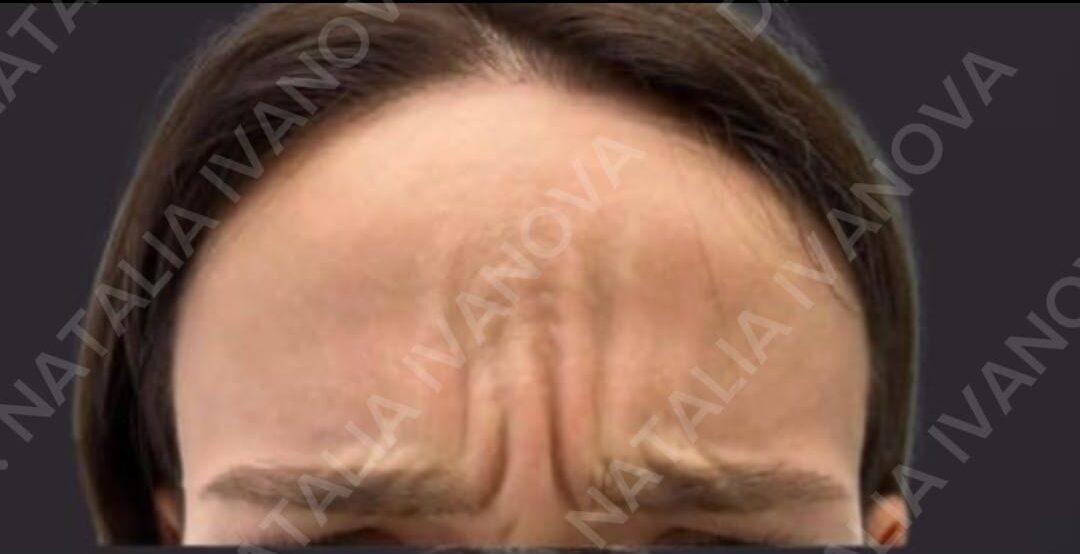 Home 205 botox2