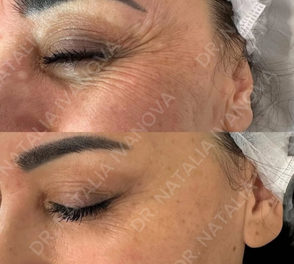 Home 208 botox6
