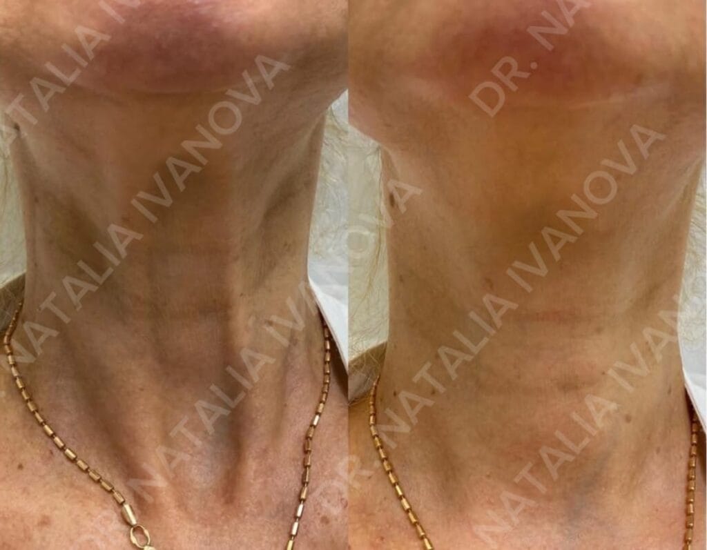 Home 209 botox7