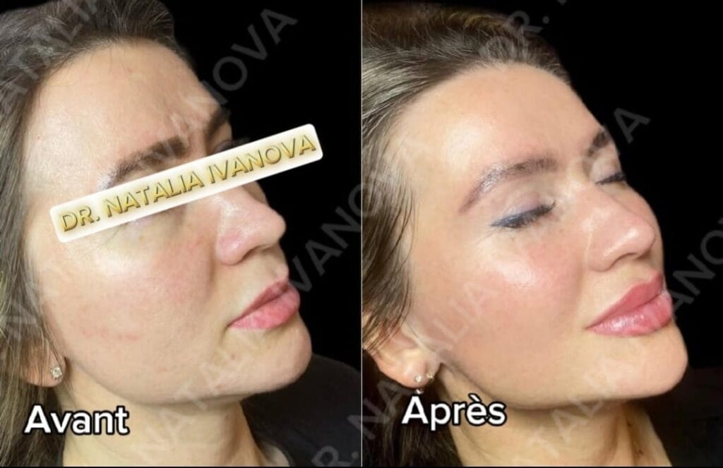 Home 228 collagen
