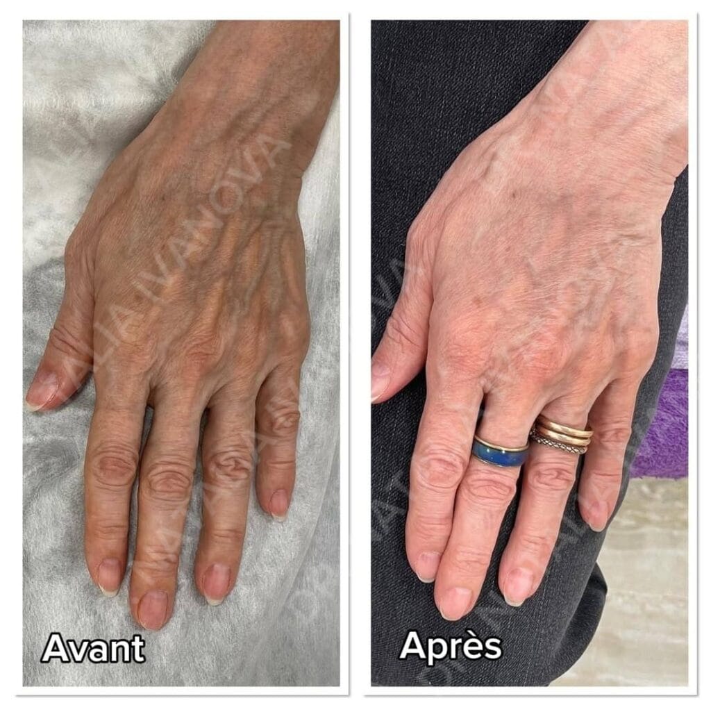Home 230 collagen2