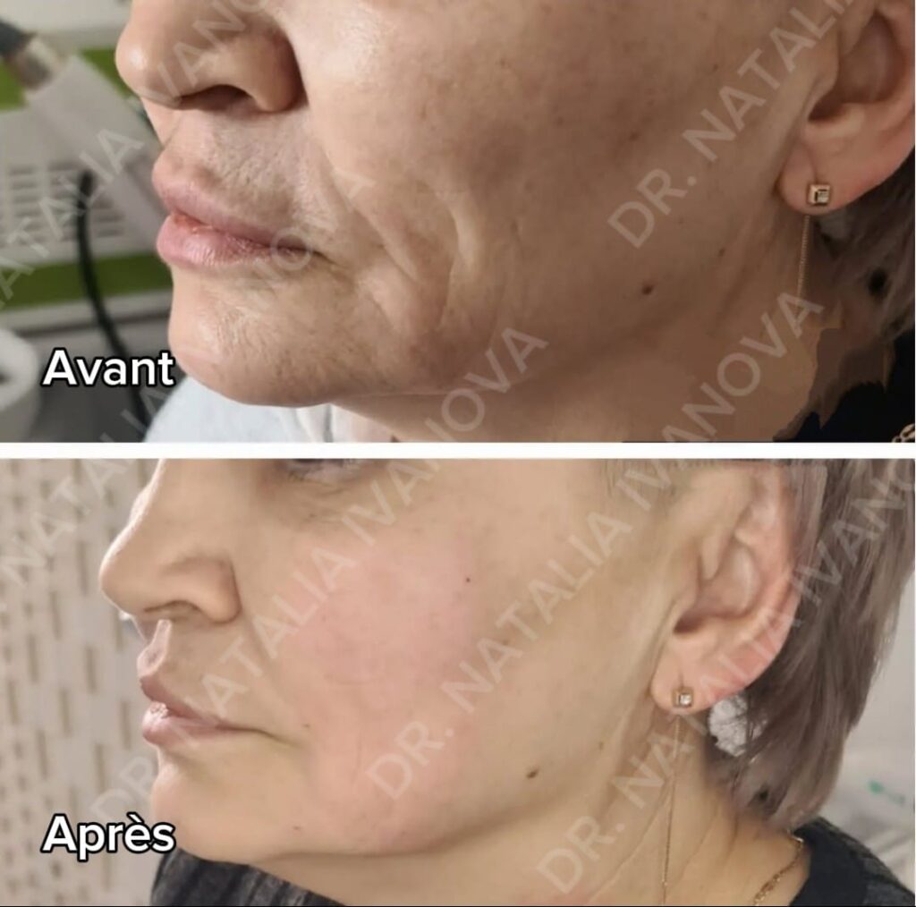 Home 229 collagen3